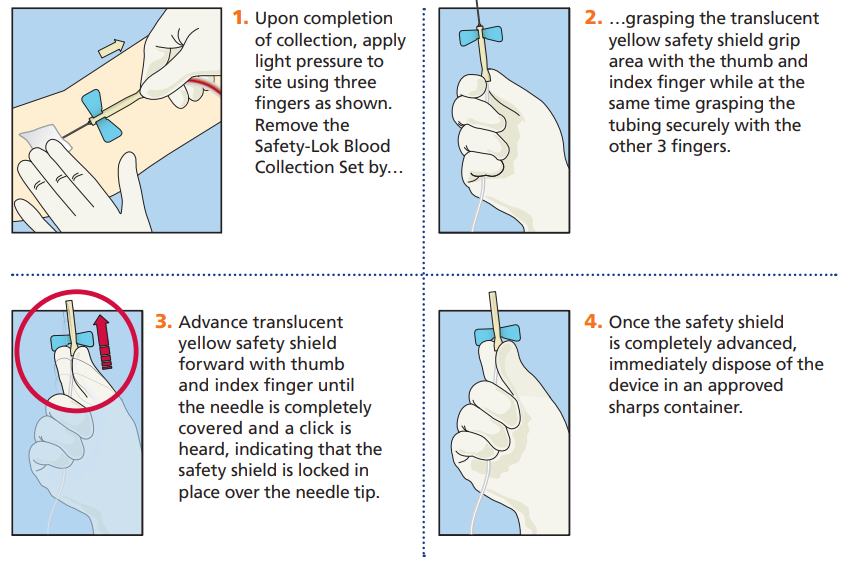 Bd vacutainer® safety-lok™ blood collection set (23G x 3/4", 12" tubing) - 367297
