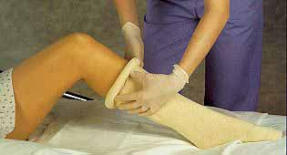 ALBA STERILE STOCKINETTE