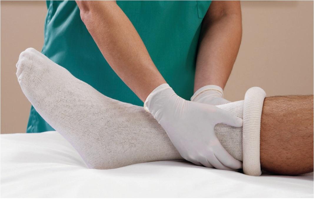 ALBA NON-STERILE STOCKINETTE