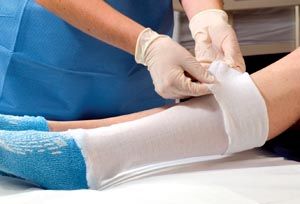 ALBA STERILE STOCKINETTE