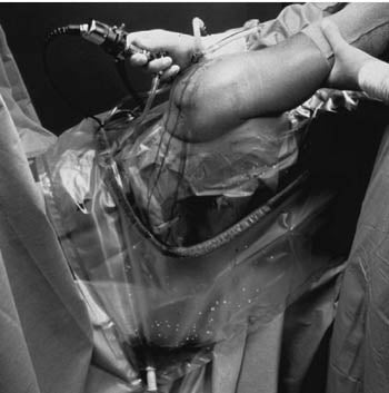 3M™ STERI-DRAPE™ U-DRAPES