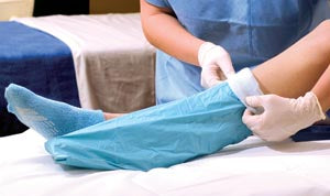 ALBA STERILE STOCKINETTE