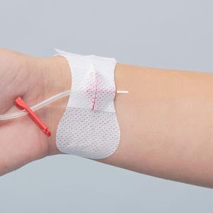 TIDI GRIP-LOK® ARTERIAL CATHETER SECUREMENT DEVICE